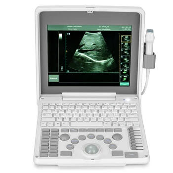 Portable SINOHERO физиотерапия 4d / 3d терапия Доплер Gyn кардио сканиране ултразвукова машина с принтер